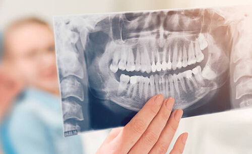 Diagnosztika a fogászatban