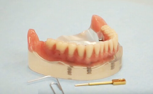 Dr. Stephan Tóka Video