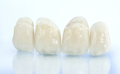 Zahnbrücke behandlungen