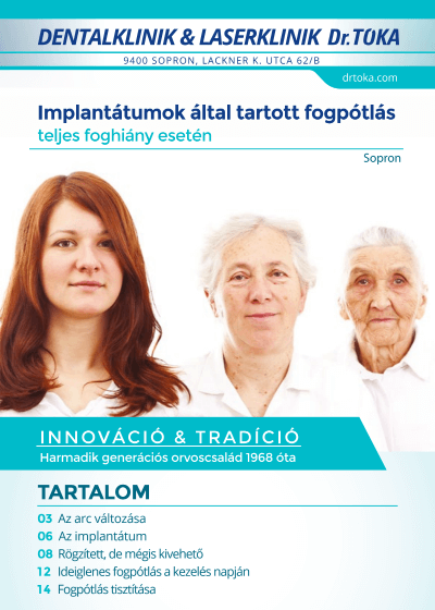 Implantátumok által rögzített fogpótlás füzet