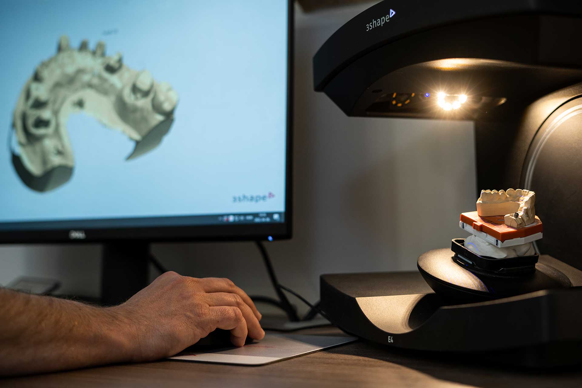 3D-Scanner